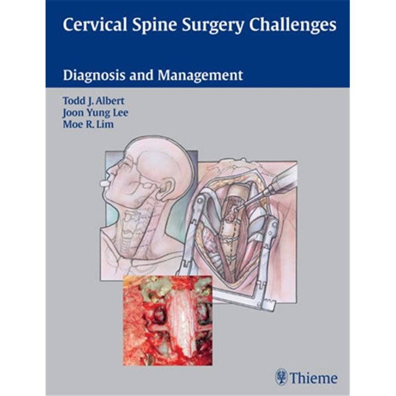 Cervical Spine Surgery Challenges - Diagnosis and Management